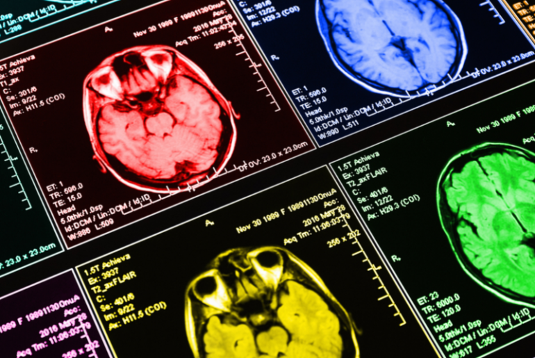 Neuroplasticity: Can You Think Yourself Into a Different Person?