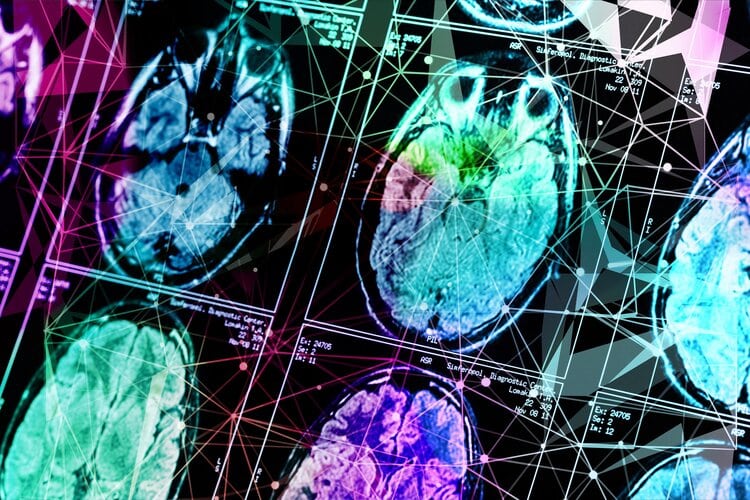 IQ tests can’t measure it, but ‘cognitive flexibility’ is key to learning and creativity