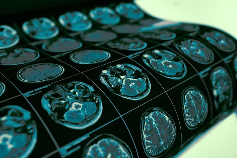 This Is How Poverty Hurts a Baby's Brain Even Before Birth
